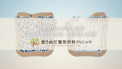 骨粗鬆症は男性も注意〜リスク要因・症状・予防法を解説のアイキャッチ画像