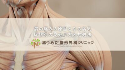 肩の痛みの原因となる病気〜症状別の見分け方と対処法のアイキャッチ画像