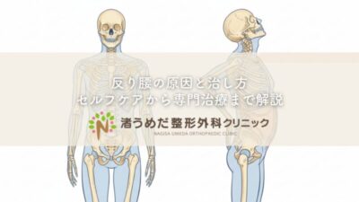 反り腰の原因と治し方〜セルフケアから専門治療まで解説のアイキャッチ画像