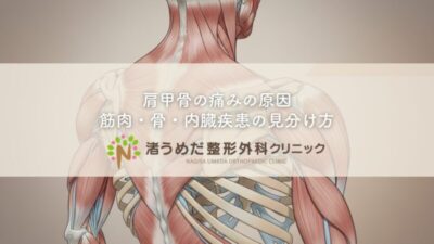 肩甲骨の痛みの原因〜筋肉・骨・内臓疾患の見分け方のアイキャッチ画像