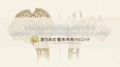 骨粗鬆症の早期発見が命を守る｜無症状でも進行する骨密度低下のリスクと対策のアイキャッチ画像