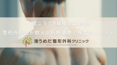 肩こりでX線検査は必要?整形外科医が教える判断基準と検査のメリットのアイキャッチ画像